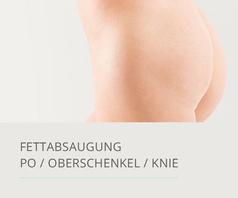 Fettabsaugung Po, Plastische Chirurgie Berlin, AesthetiCum, Dr. Ahrens, Dr. Fritzsch 