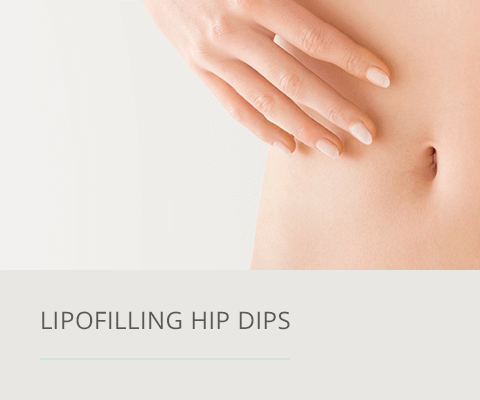 Lipofilling Hip Dips, Plastische Chirurgie Berlin, AesthetiCum, Dr. Ahrens, Dr. Fritzsch 