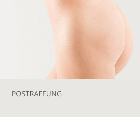 Postraffung, Plastische Chirurgie Berlin, AesthetiCum, Dr. Ahrens, Dr. Fritzsch 